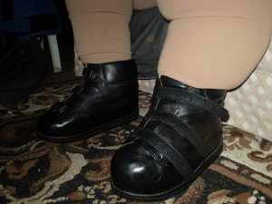 Custom made orthopedic shoes cheap near me